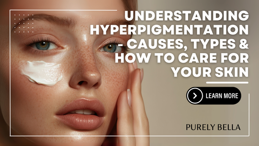 Understanding Hyperpigmentation- Causes, Types & How to Care for Your Skin