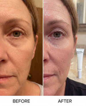 Before and after comparison of a woman's face with a tight & bright peptide eye gel product shown.