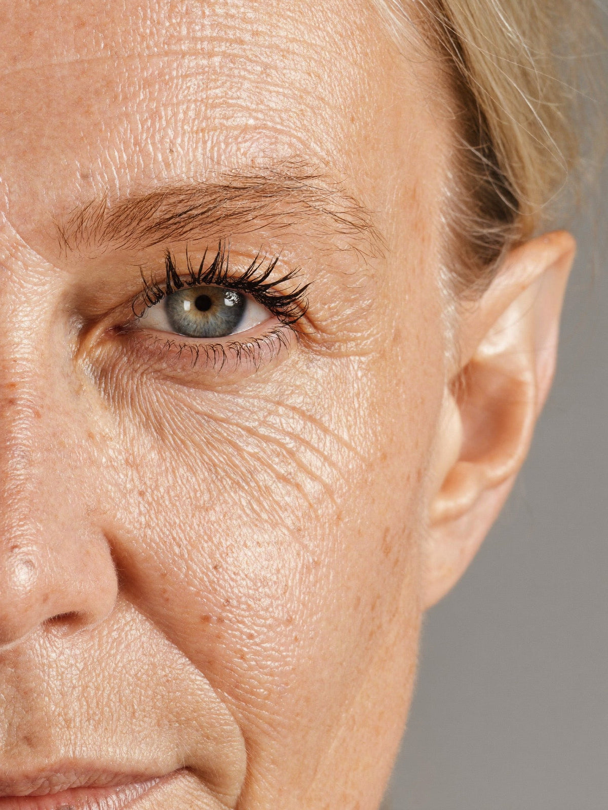 Perimenopause and Your Skin