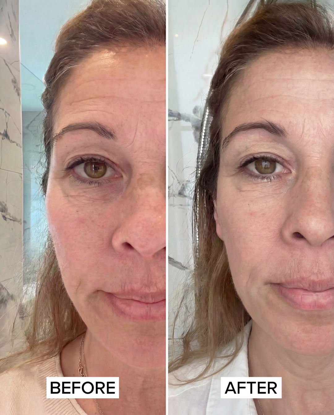 Before and after using The Perimenopause Method — softer, more even complexion