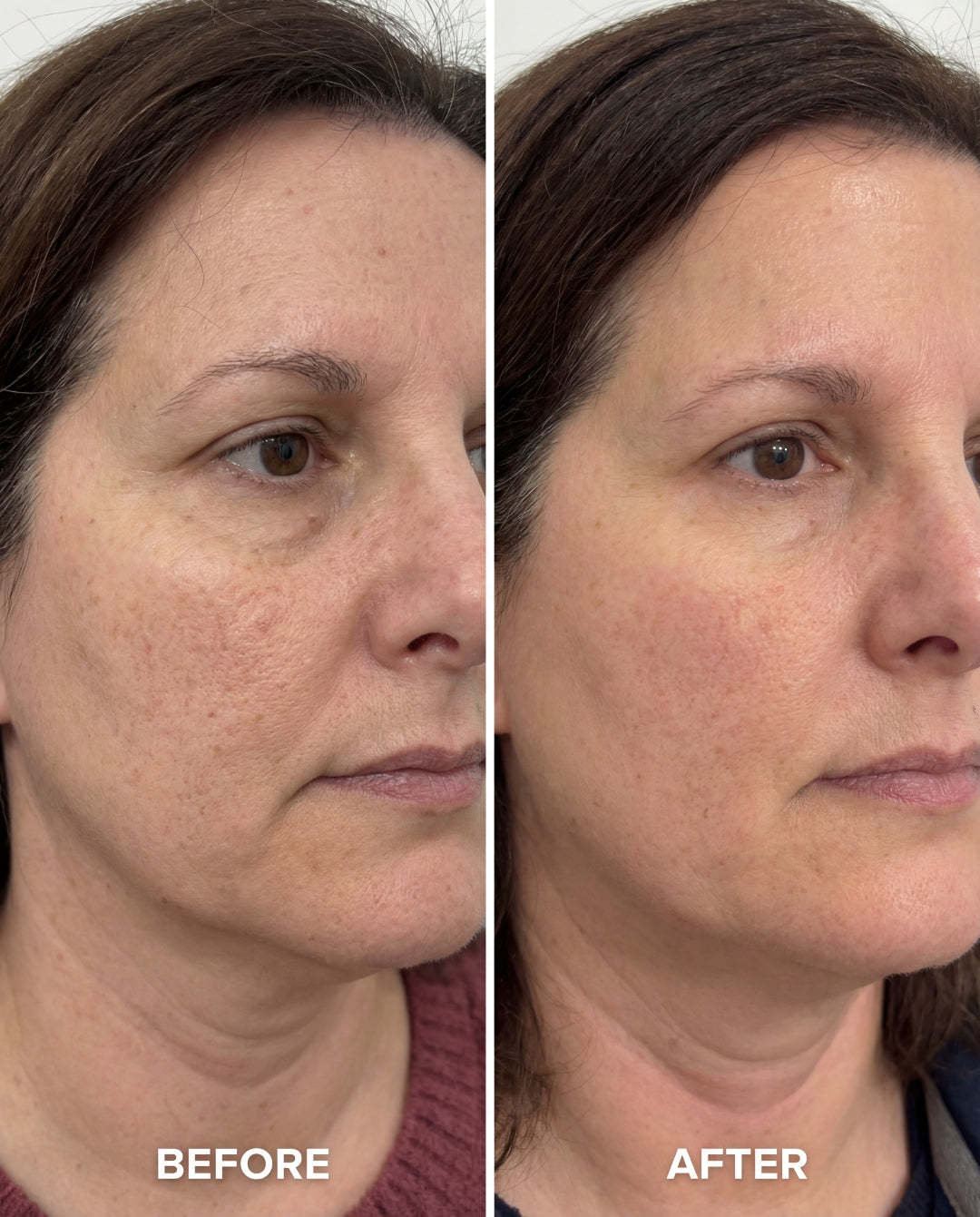 Before and after using The Perimenopause Method — clearer, brighter skin