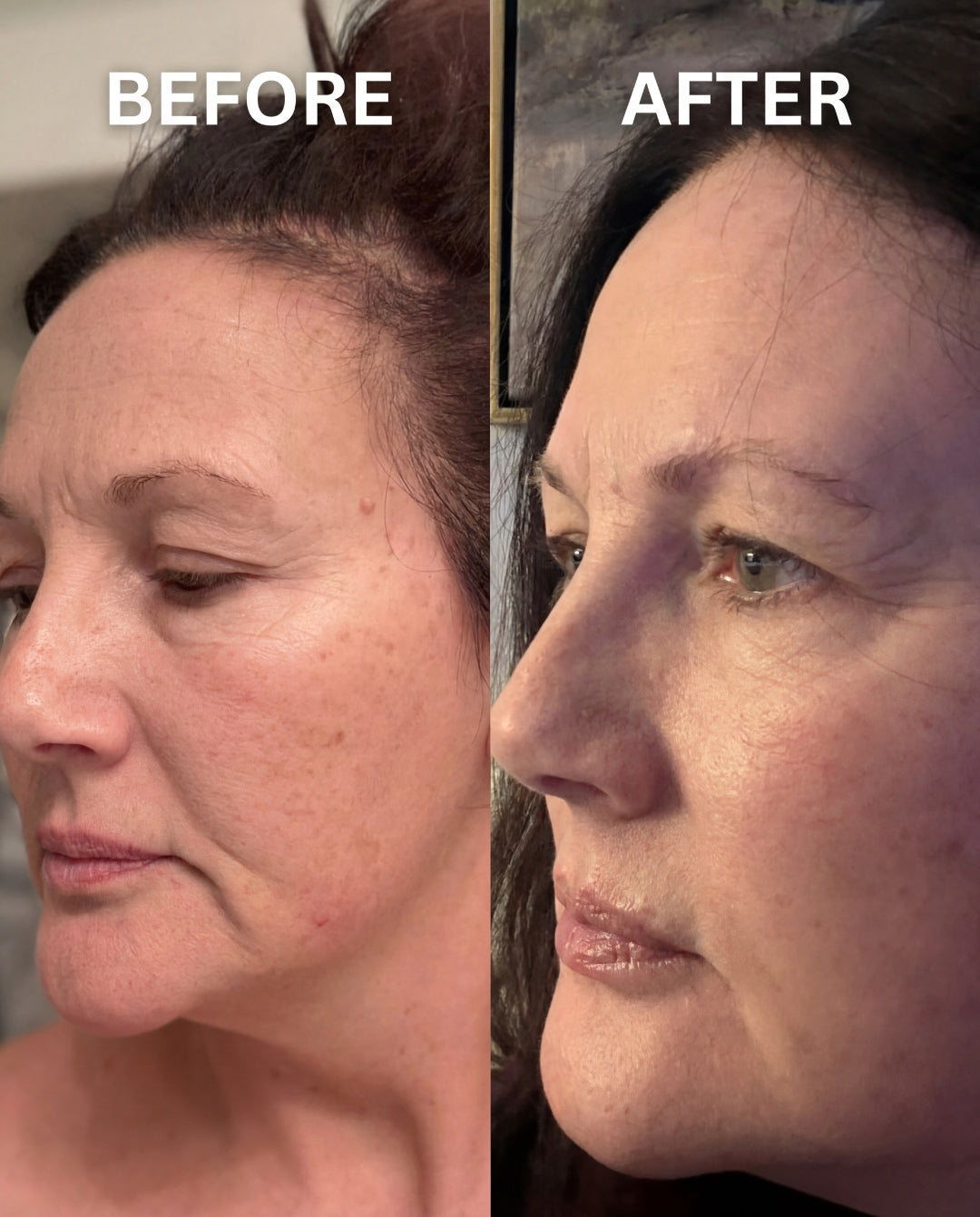 Before and after using Dream Skin Night Cream — plumper, smoother skin