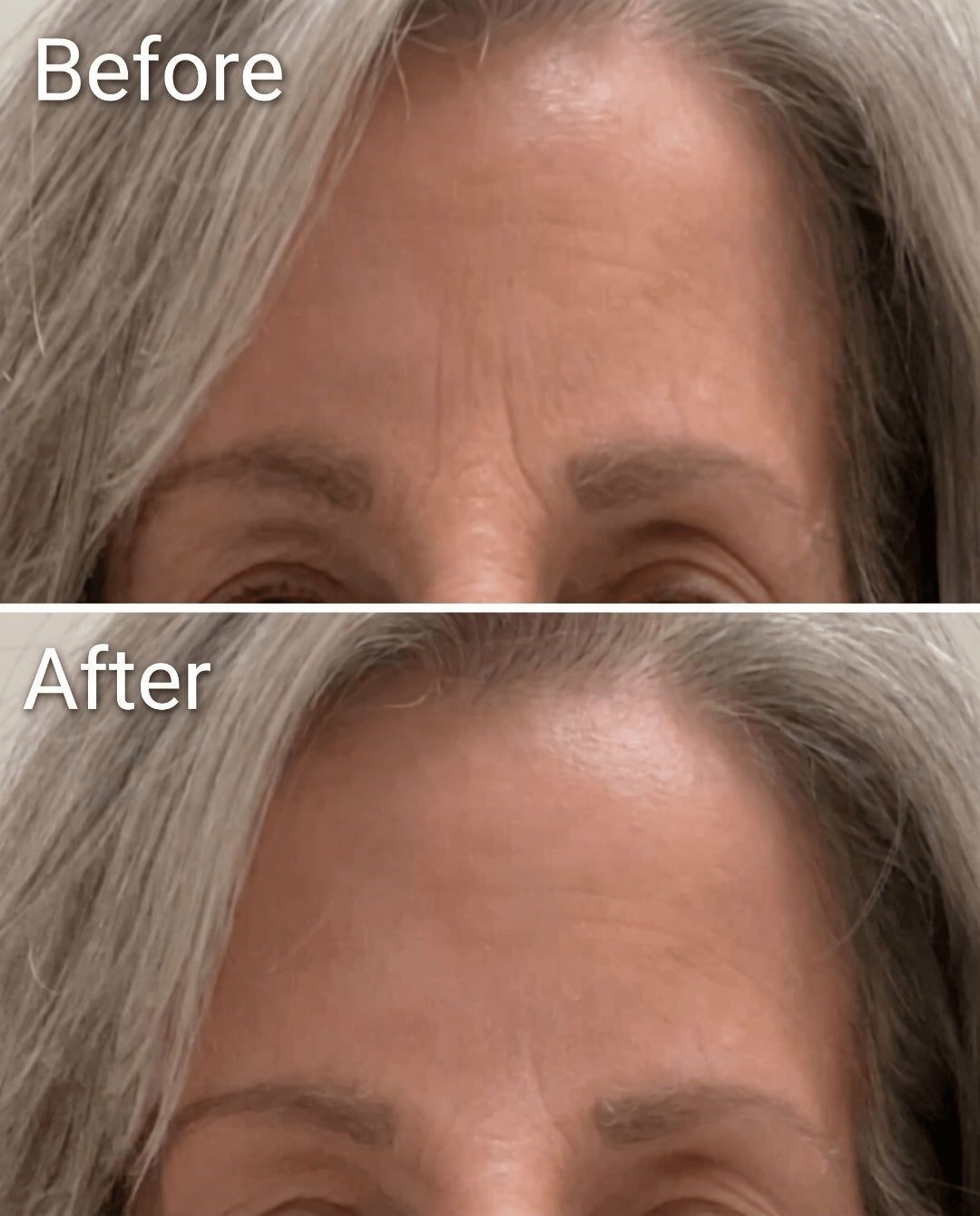 Before and after using Flawless Brightening Moisturizer — smoother forehead, softened lines