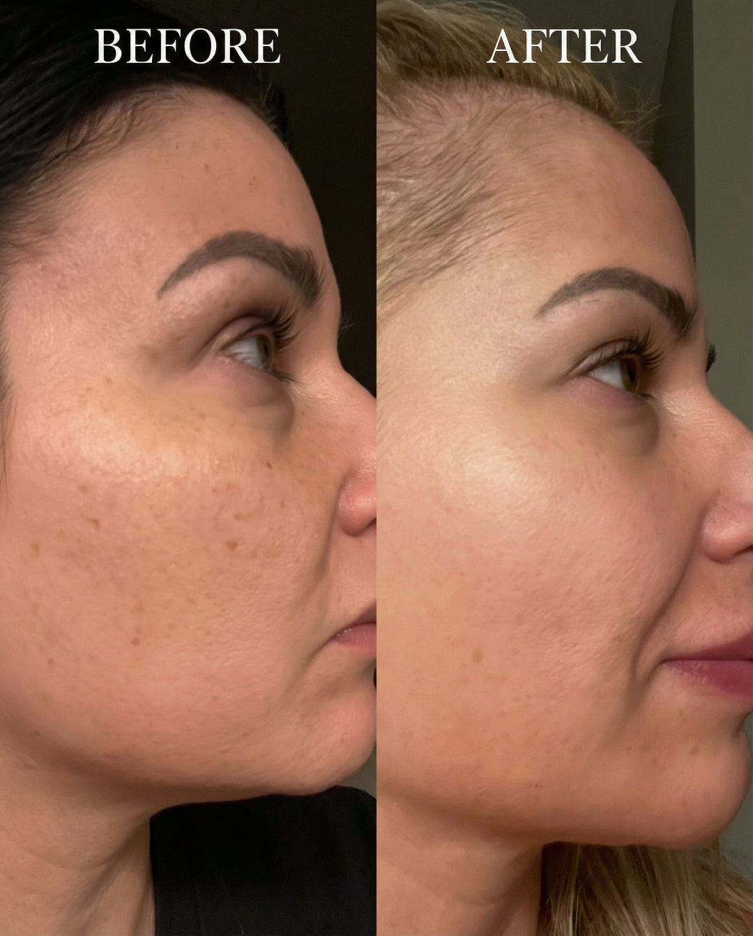 Before and after using The Perimenopause Method — smoother, more even skin